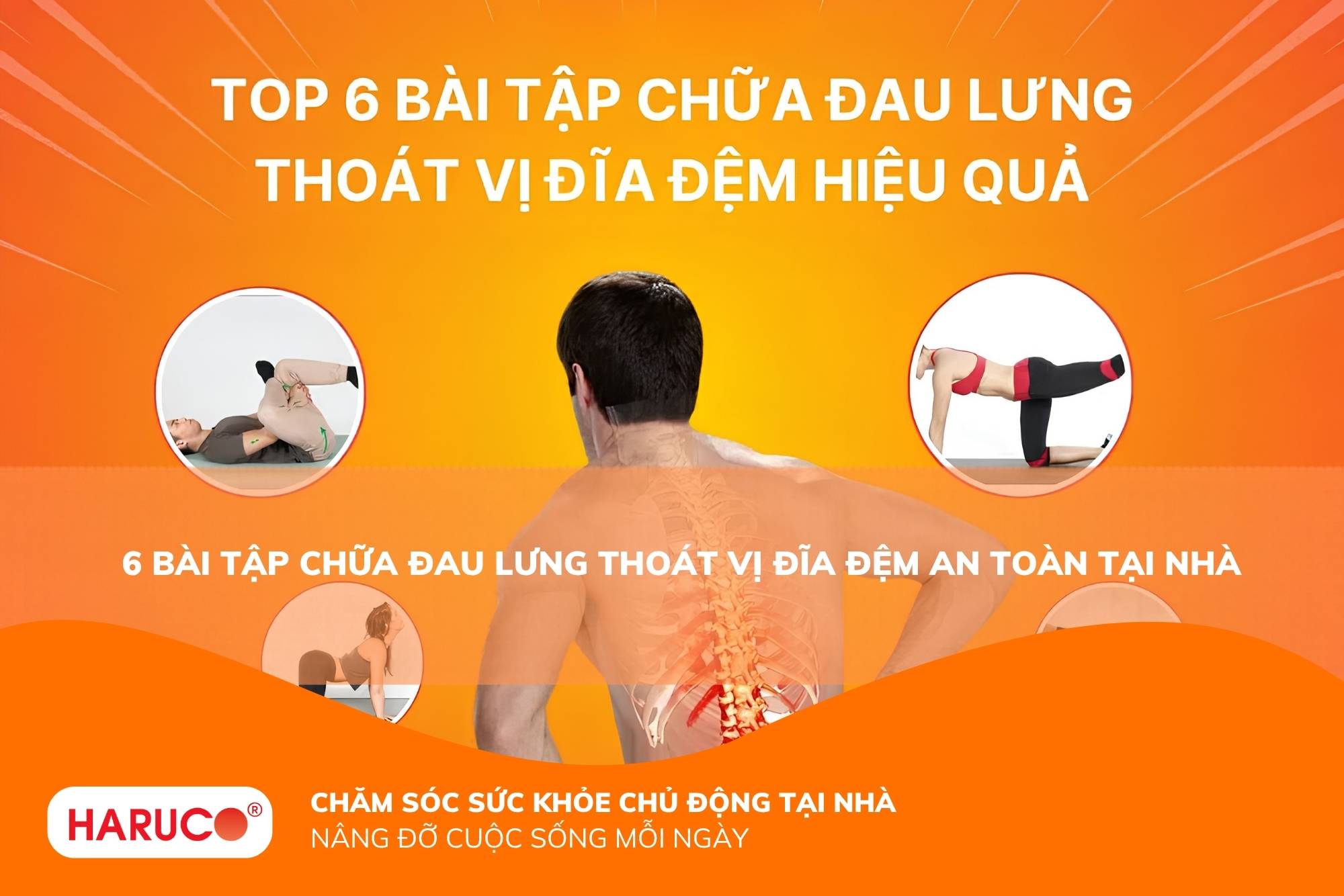 Top 6 bài tập chữa đau lưng thoát vị đĩa đệm hiệu quả