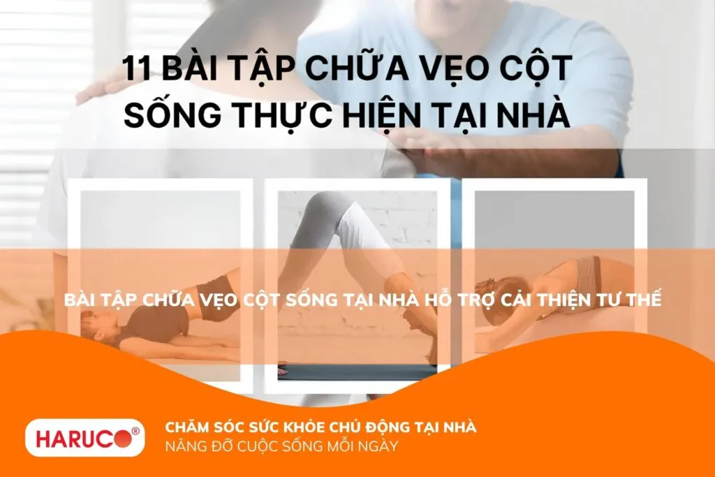 Bài tập chữa vẹo cột sống tại nhà hỗ trợ cải thiện tư thế