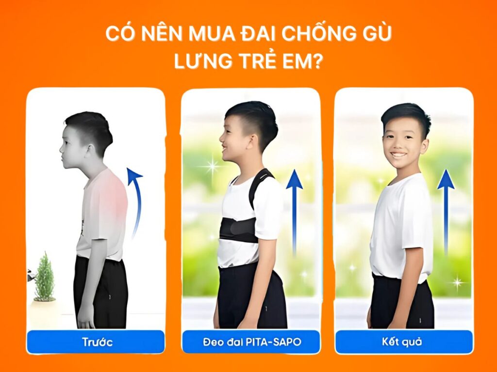 Có nên mua đai chống gù lưng trẻ em?