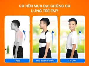 Có nên mua đai chống gù lưng trẻ em?