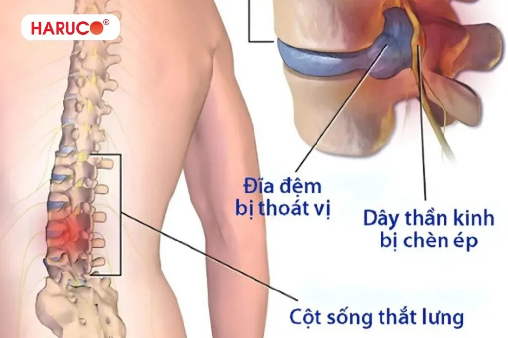 đai lưng cột sống thoát vị đĩa đệm hỗ trợ cột sống 