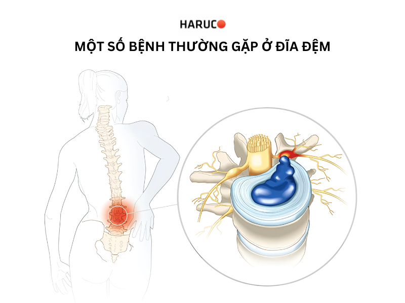 dai-lung-cot-song-haruco