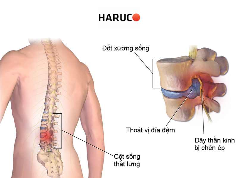 dai-lung-cot-song-haruco