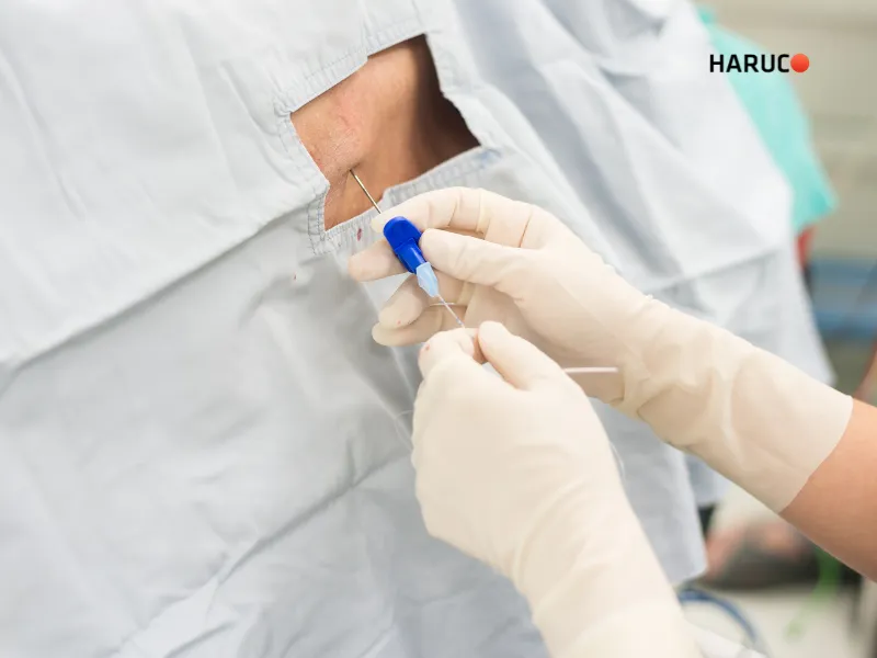 Điều trị thoát vị đĩa đệm - 6