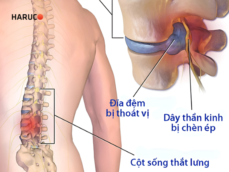 dai-lung-cot-song-haruco