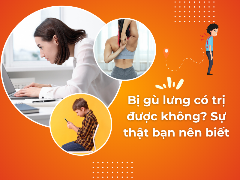 Bị gù lưng có trị được không? Sự thật bạn nên biết