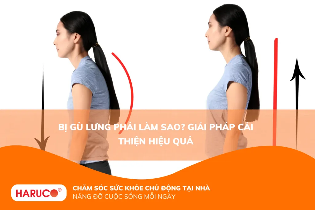 Bị gù lưng phải làm sao? Giải pháp cải thiện hiệu quả