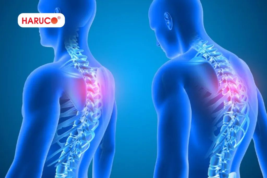 4 bước nhận biết tình trạng bị gù lưng tại nhà