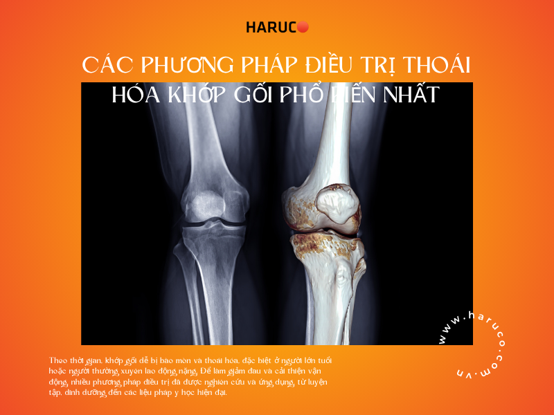 Các phương pháp điều trị thoái hóa khớp gối phổ biến nhất