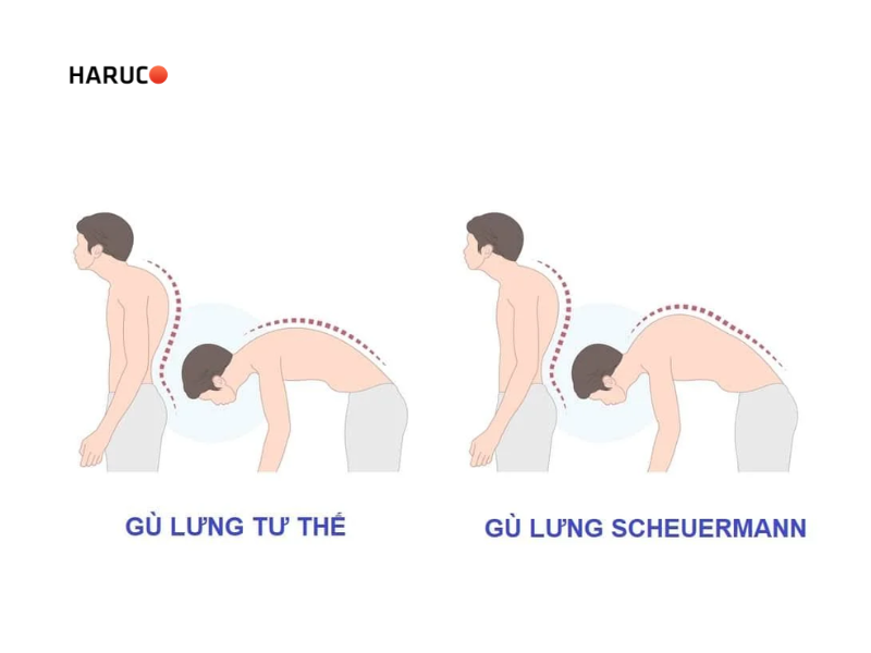 dai-lung-chong-gu-haruco