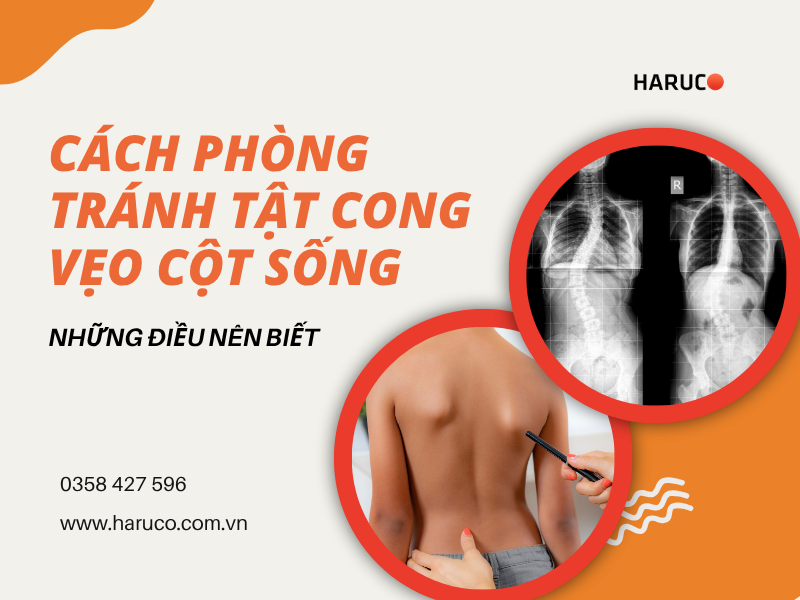 Cách phòng tránh tật cong vẹo cột sống: Những điều nên biết