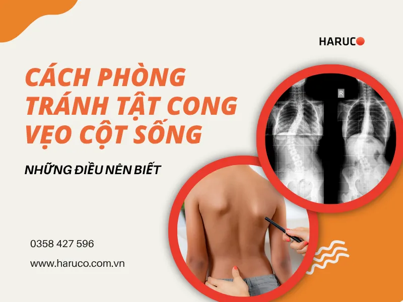 cách phòng tránh tật cong vẹo cột sống