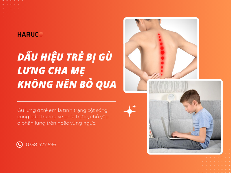 Dấu hiệu trẻ bị gù lưng cha mẹ không nên bỏ qua