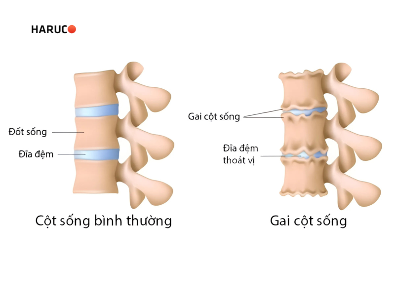 dai-lung-cot-song-haruco