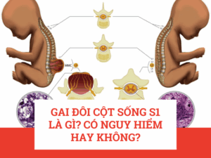 dai-lung-cot-song-haruco