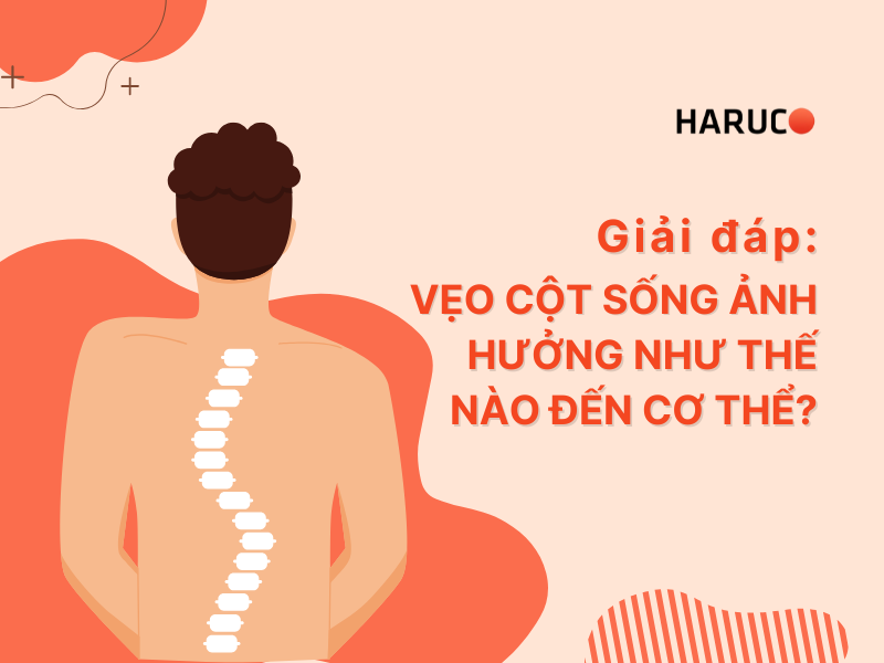 Giải đáp: Vẹo cột sống ảnh hưởng như thế nào đến cơ thể?