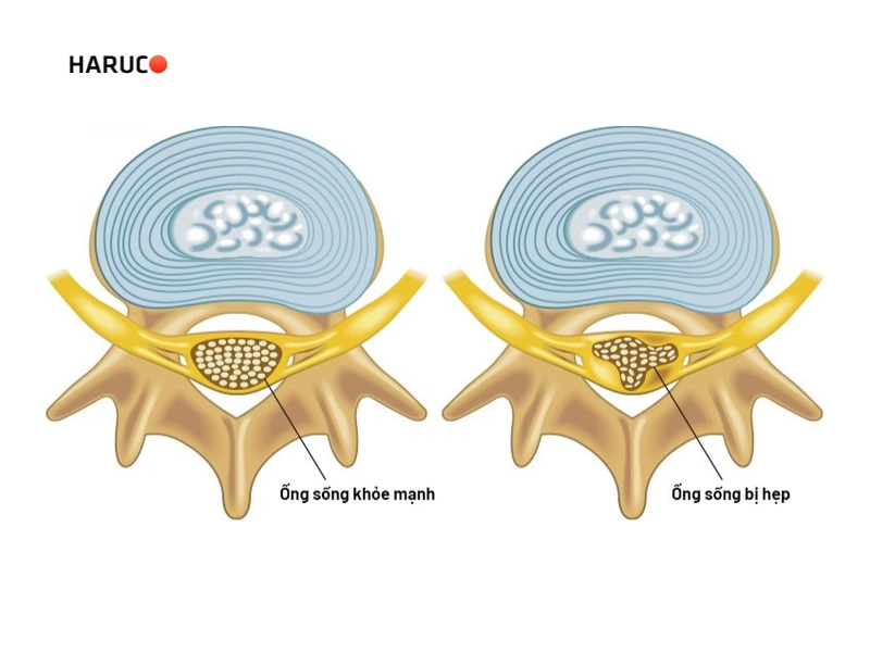 dai-lung-cot-song-haruco