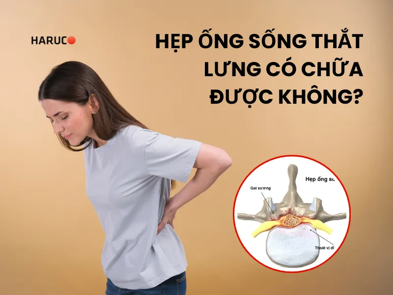 Hẹp ống sống thắt lưng có chữa được không