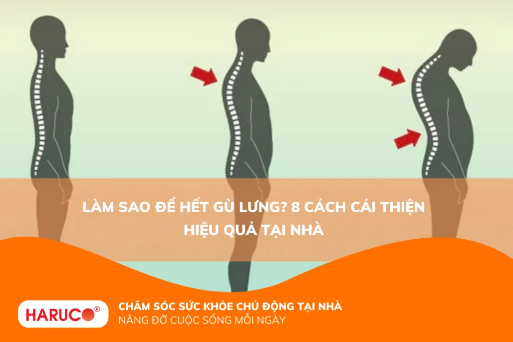 Làm sao để hết gù lưng? 5 cách cải thiện tư thế hiệu quả