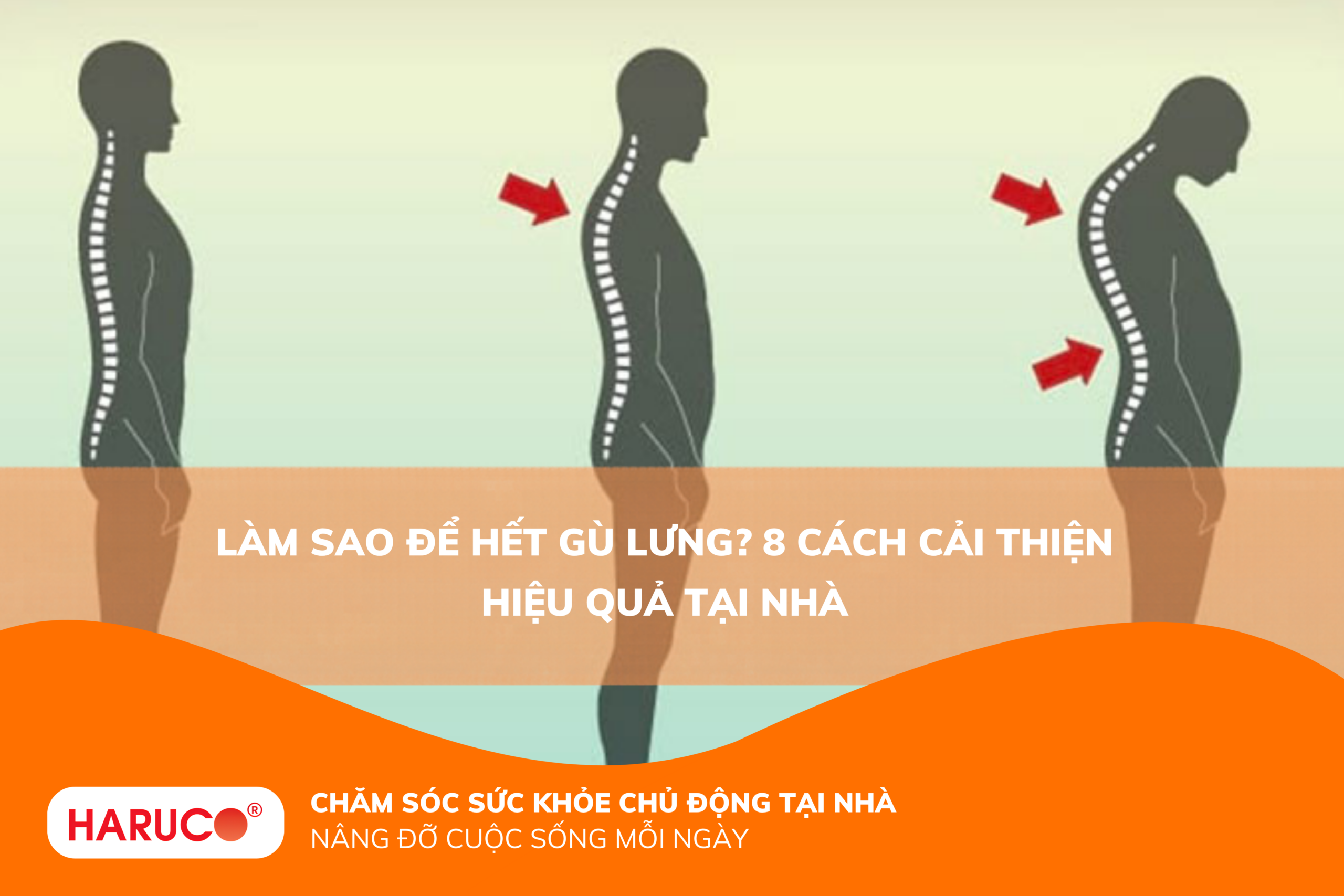 Làm sao để hết gù lưng? 5 cách cải thiện tư thế hiệu quả