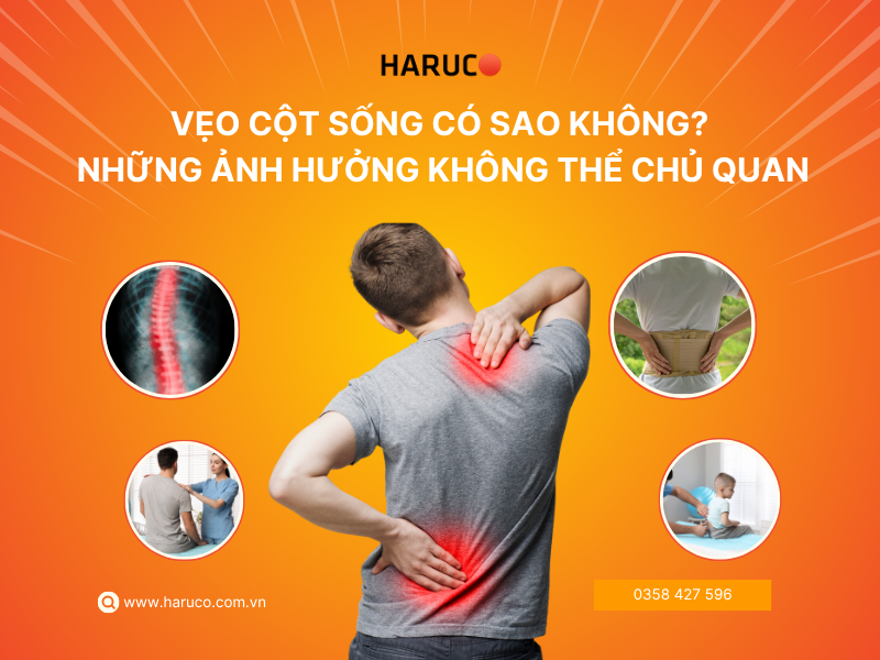 Vẹo cột sống có sao không? Những ảnh hưởng nghiêm trọng