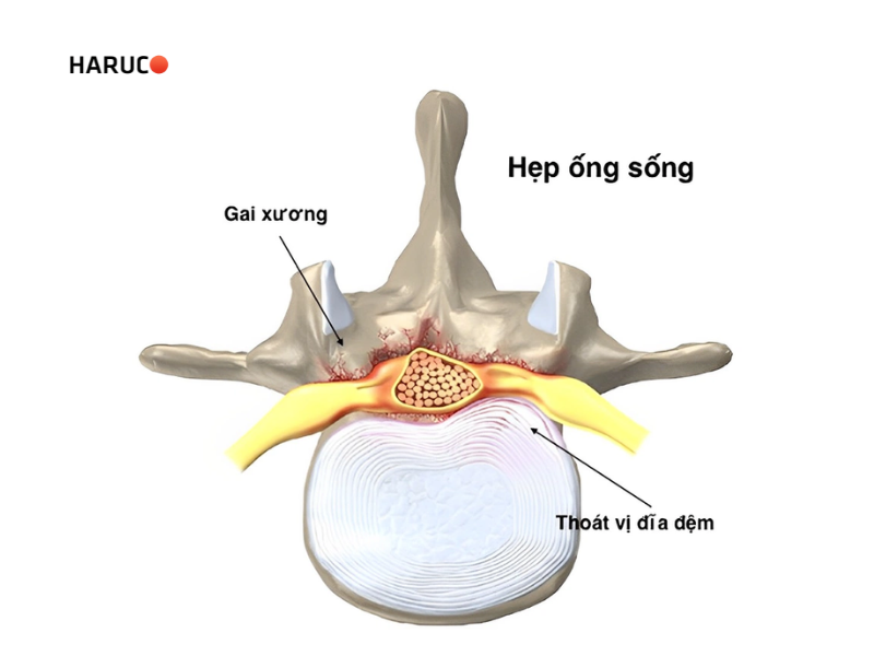dai-lung-cot-song-haruco