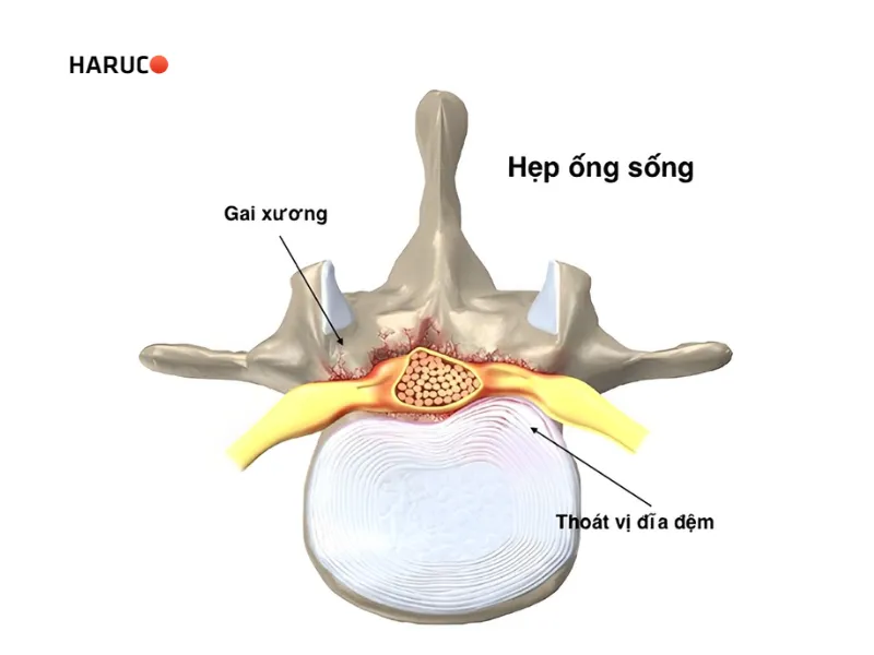 dai-lung-cot-song-haruco