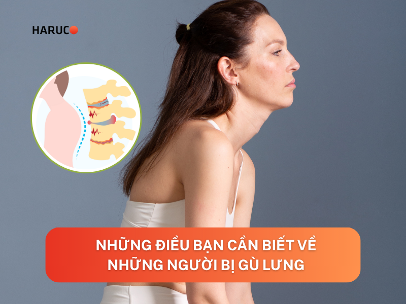 Những điều bạn cần biết về những người bị gù lưng
