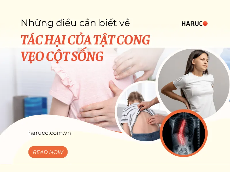 tác hại của tật cong vẹo cột sống