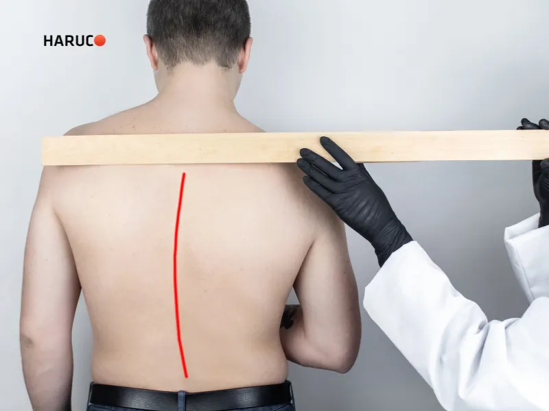 vẹo cột sống có sao không