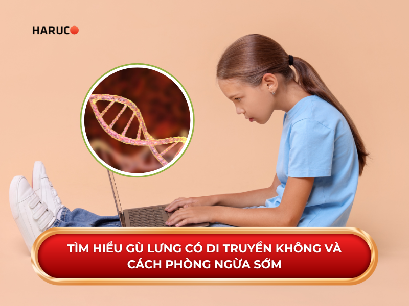 Tìm hiểu gù lưng có di truyền không và cách phòng ngừa sớm