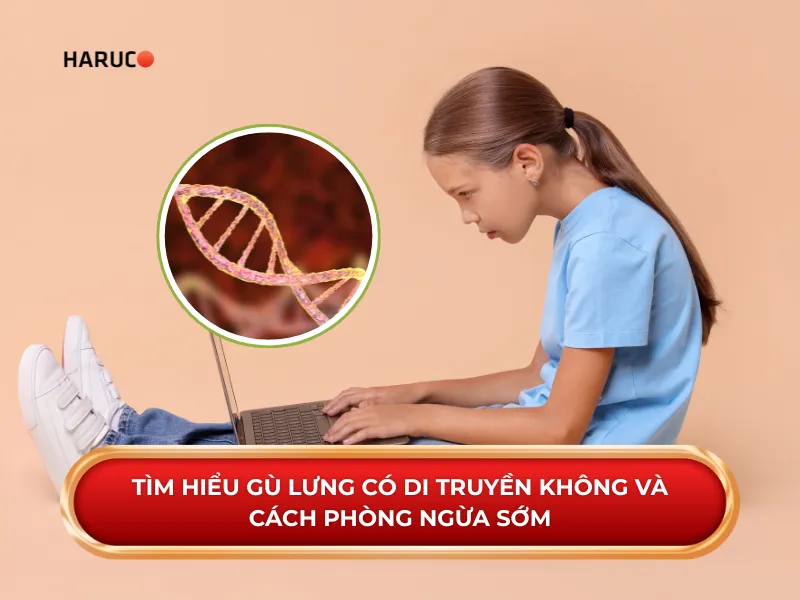 gù lưng có di truyền không