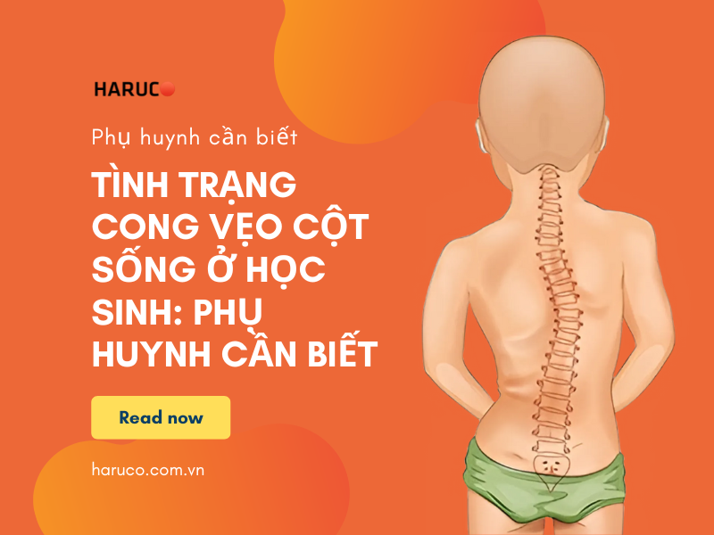 Tình trạng cong vẹo cột sống ở học sinh: Phụ huynh cần biết