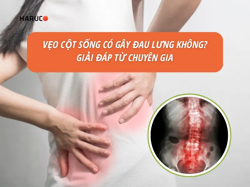 vẹo cột sống có gây đau lưng không