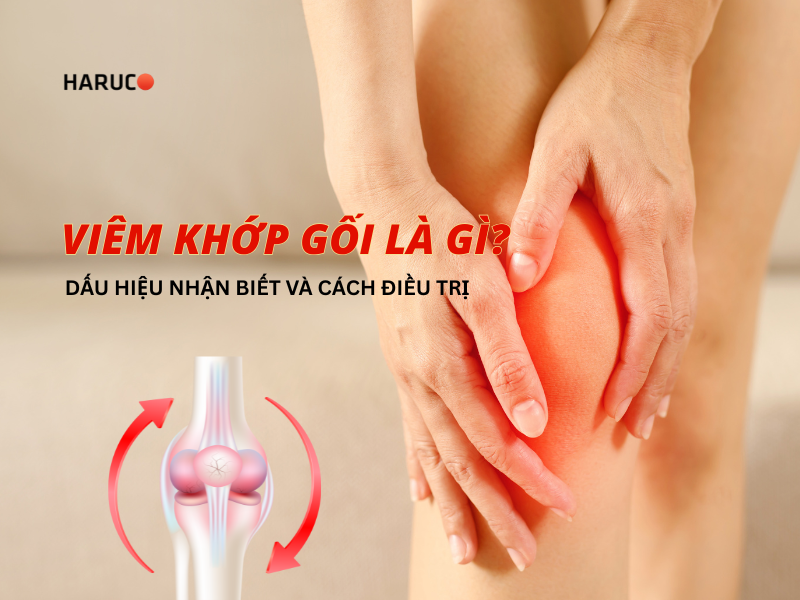 Viêm khớp gối là gì? Dấu hiệu nhận biết và cách điều trị
