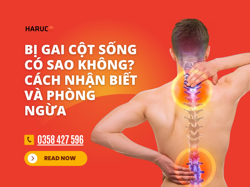 Bị gai cột sống có sao không? Cách nhận biết và phòng ngừa