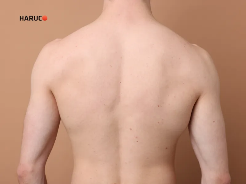 dấu hiệu bị cong vẹo cột sống - 2