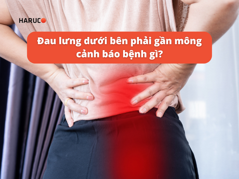 Đau lưng dưới bên phải gần mông cảnh báo bệnh gì?