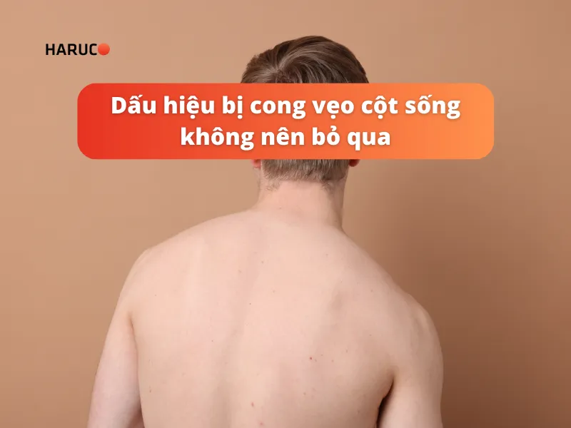 dấu hiệu bị cong vẹo cột sống