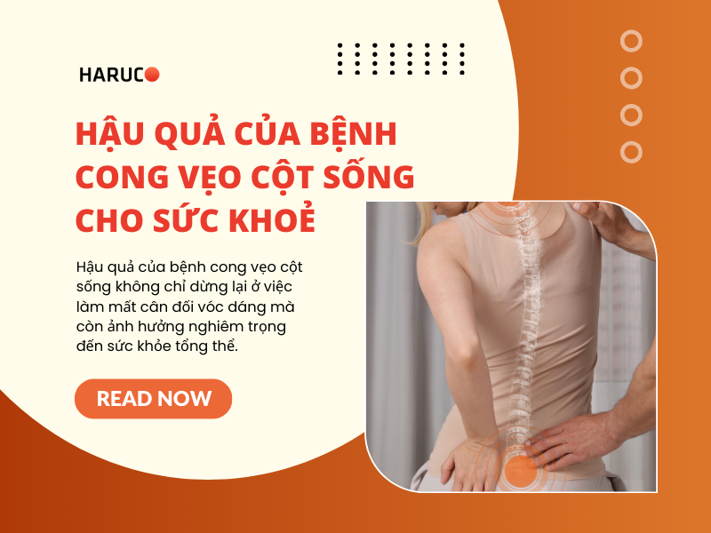 Hậu quả của bệnh cong vẹo cột sống cho sức khoẻ