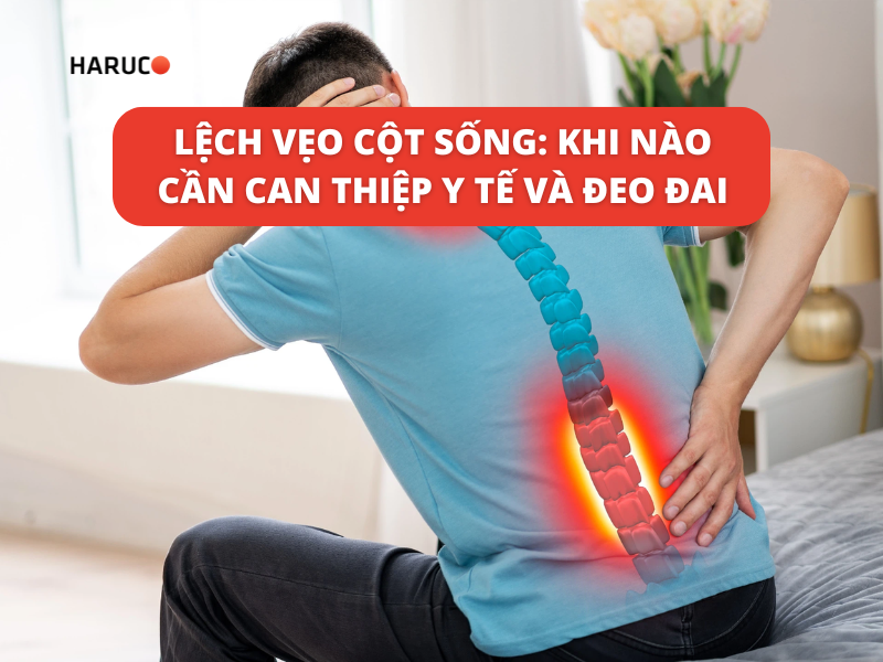 Lệch vẹo cột sống: Khi nào cần can thiệp y tế và đeo đai
