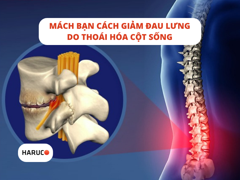 Mách bạn cách giảm đau lưng do thoái hóa cột sống
