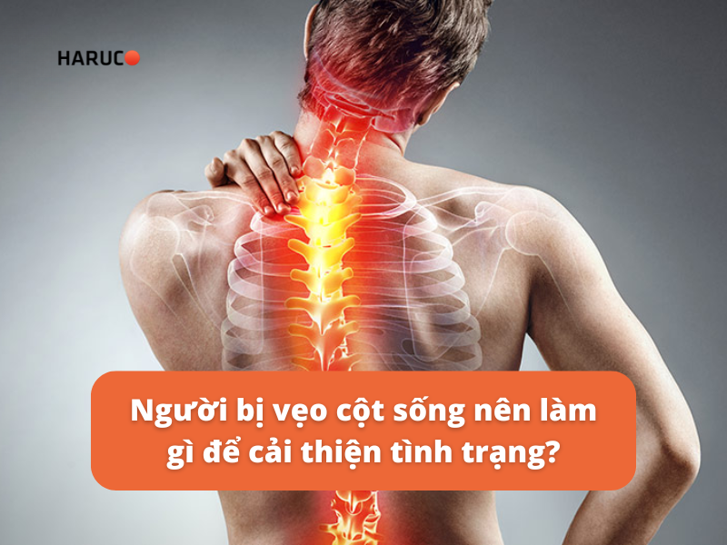 Người bị vẹo cột sống nên làm gì để cải thiện tình trạng?