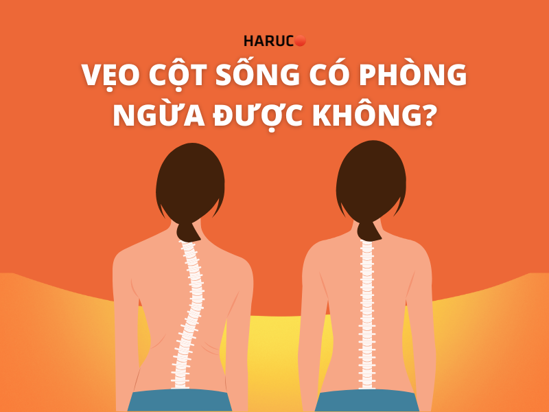 Vẹo cột sống có phòng ngừa được không?