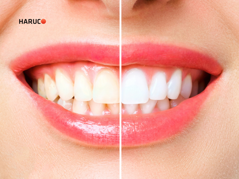 may-lay-cao-rang-haruco