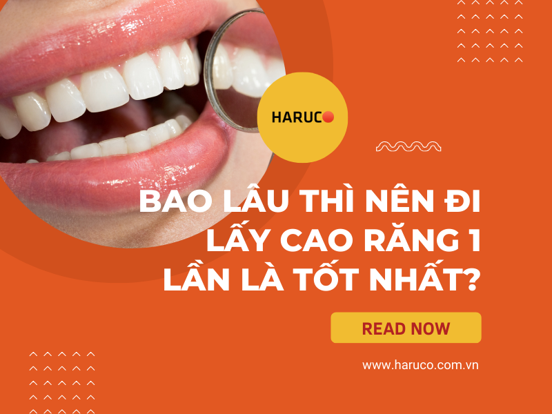 Bao lâu thì nên đi lấy cao răng 1 lần là tốt nhất?