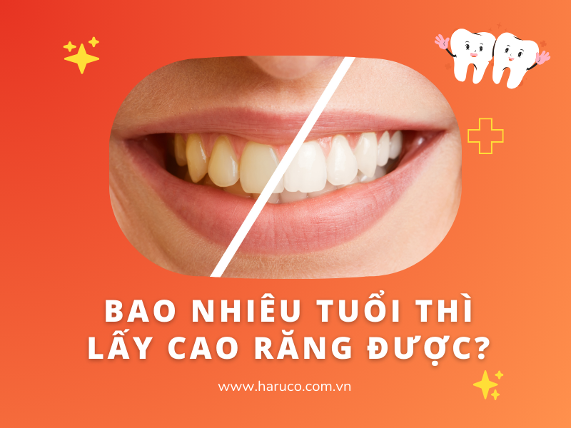 Bao nhiêu tuổi thì lấy cao răng được?