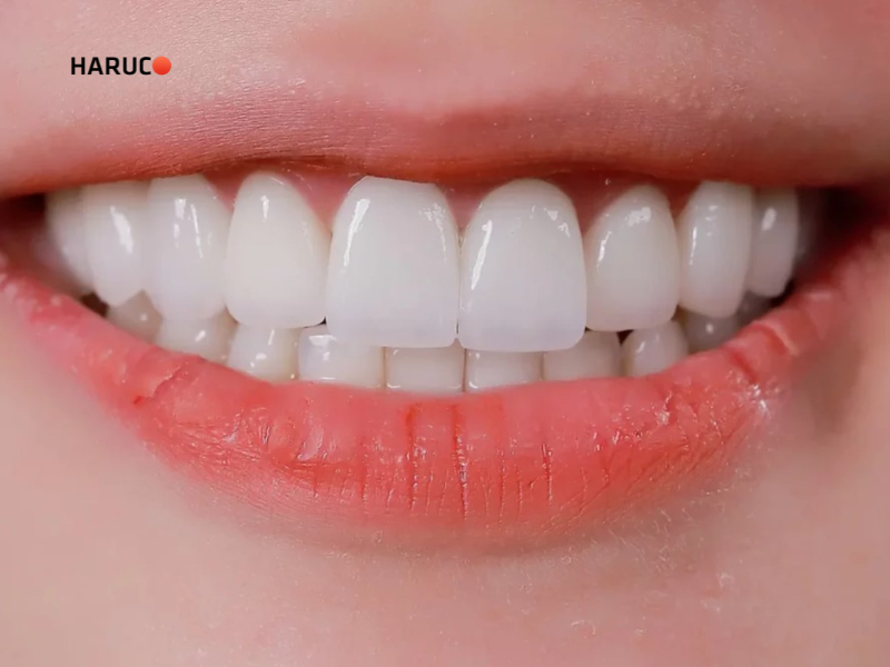 may-lay-cao-rang-haruco