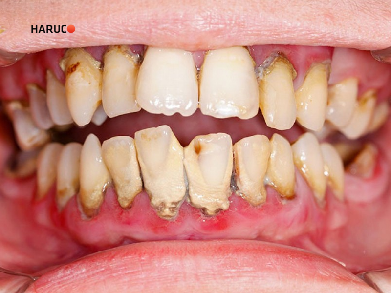 may-lay-cao-rang-haruco