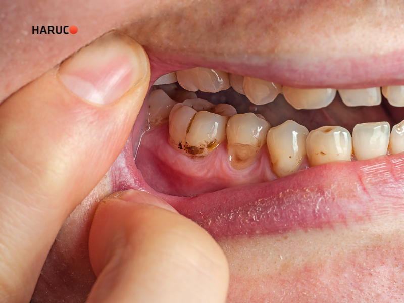 may-lay-cao-rang-haruco